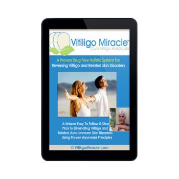 How I Healed My Severe Vitiligo