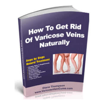 Secrets Of Varicose Veins