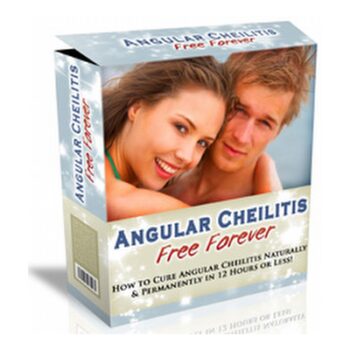 Angular cheilitis free