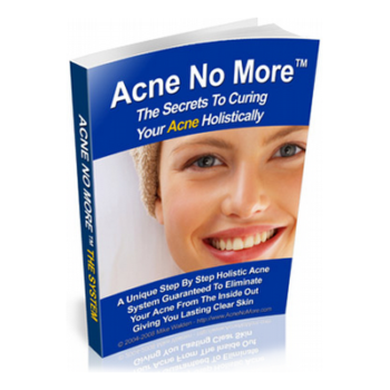 Can You Cure Acne Naturally?