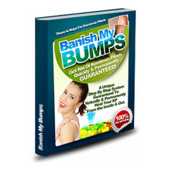 Banish my bumps