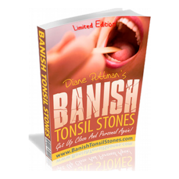 Banish tonsil stones VSL