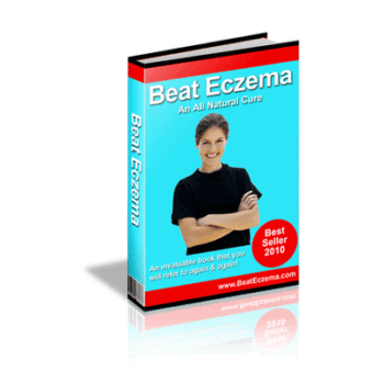 Guide to Beat Eczema