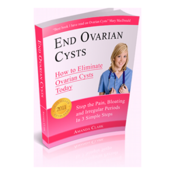 End ovarian cysts